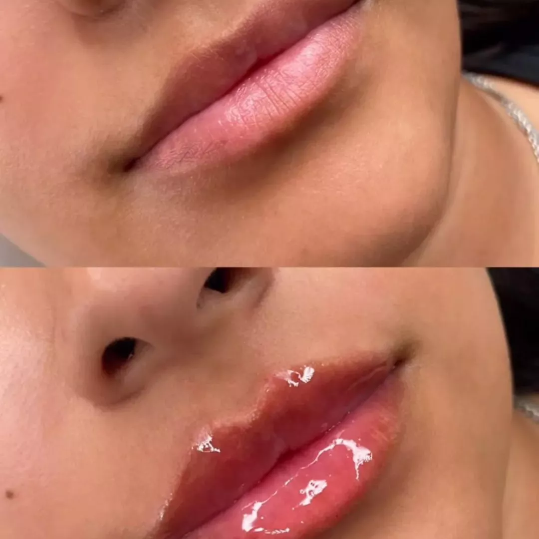 estetica (11) (1)