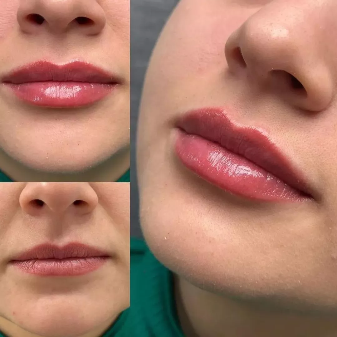 estetica (3) (1)