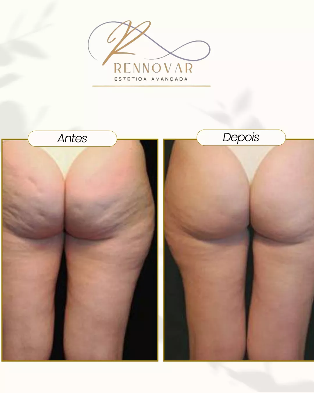 estetica (32)