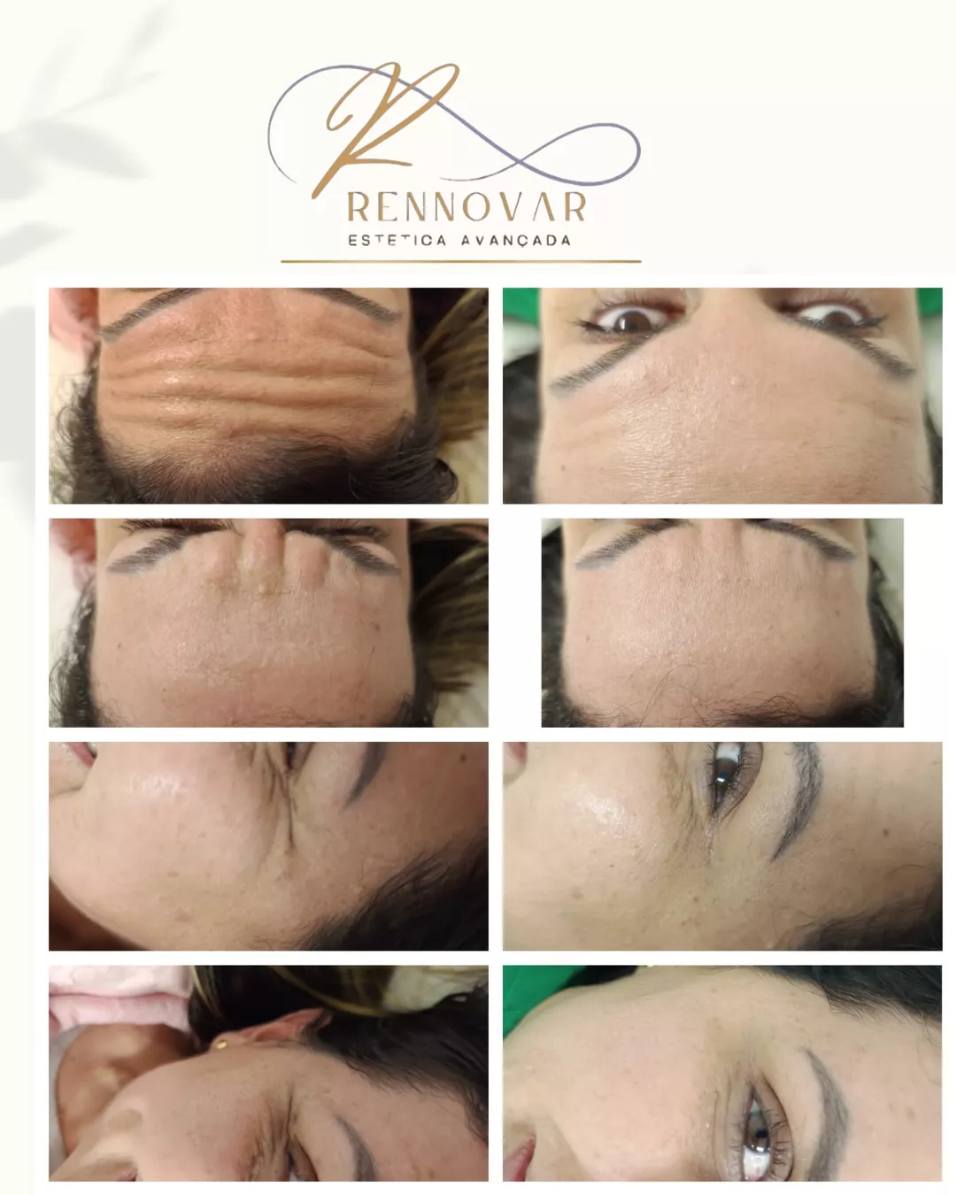 estetica (33)