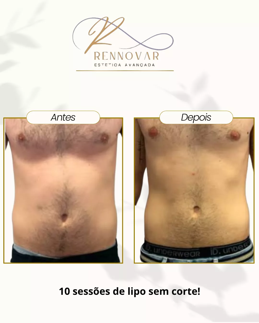 estetica (34)