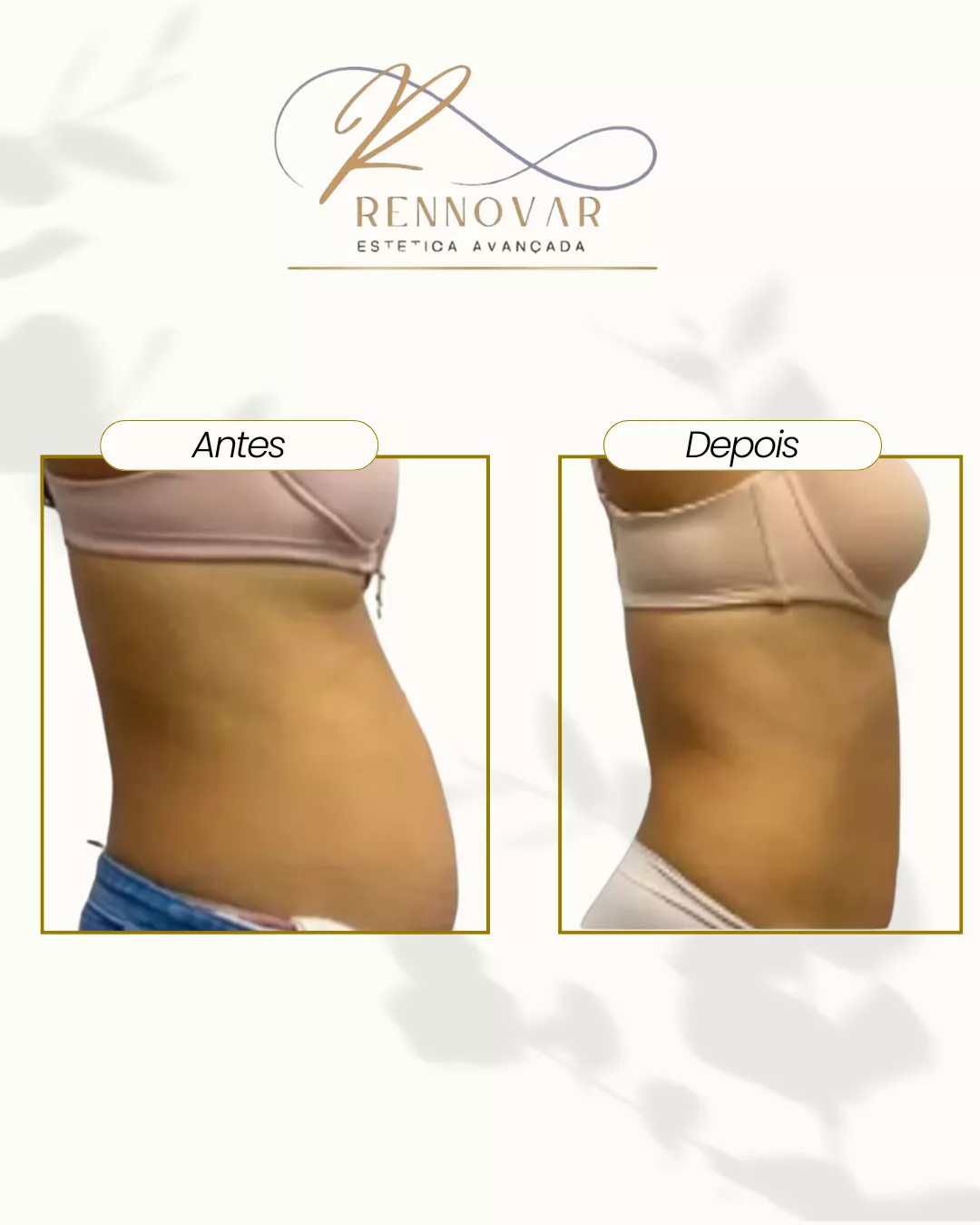 estetica (35)