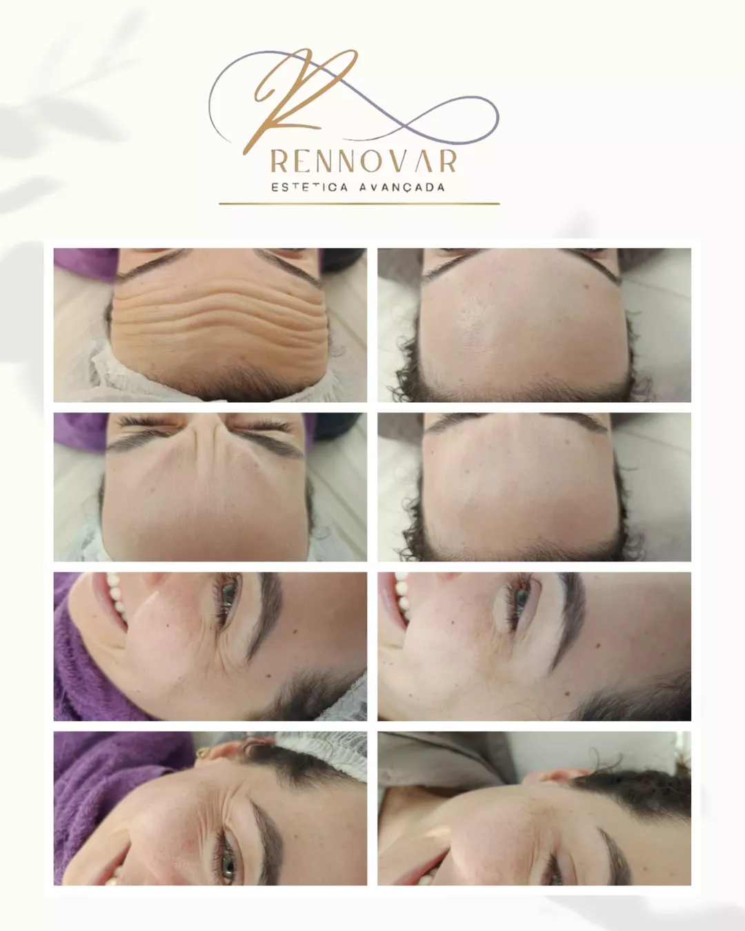 estetica (36)