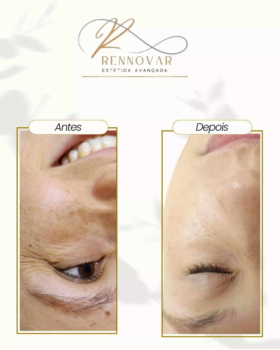 estetica (37)