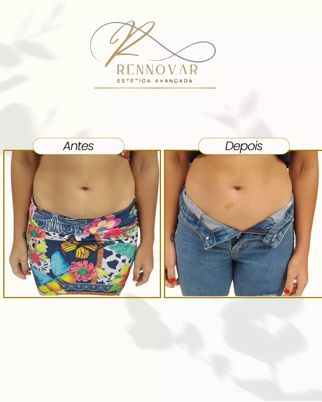 estetica (38)