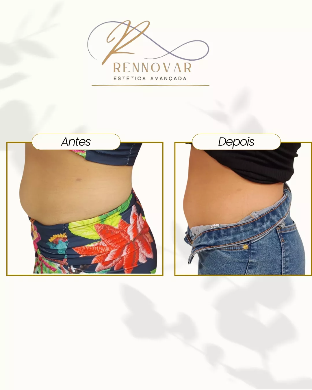 estetica (39)