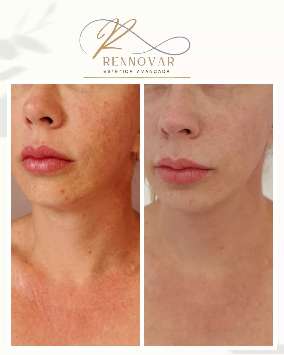 estetica (42)