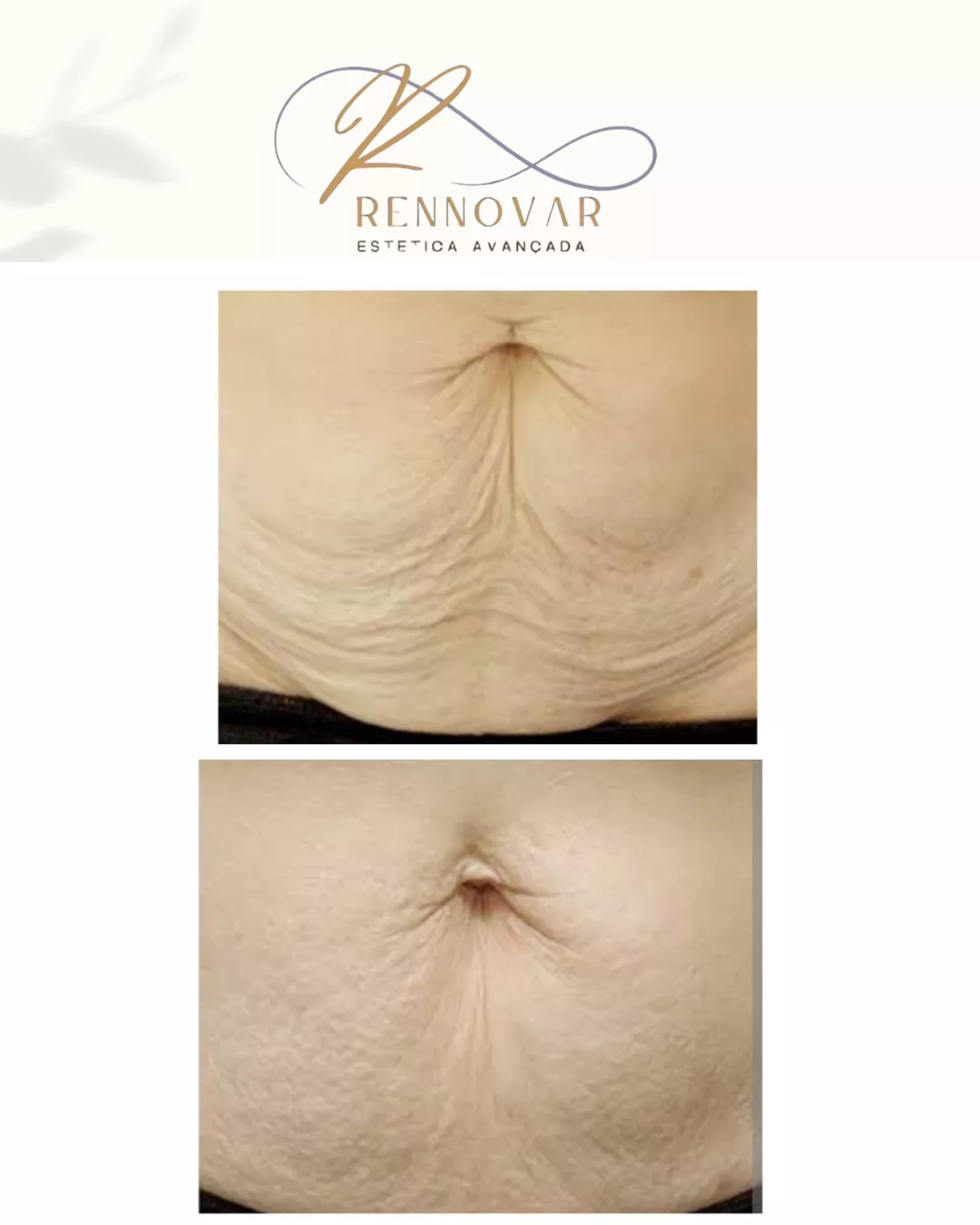 estetica (43)