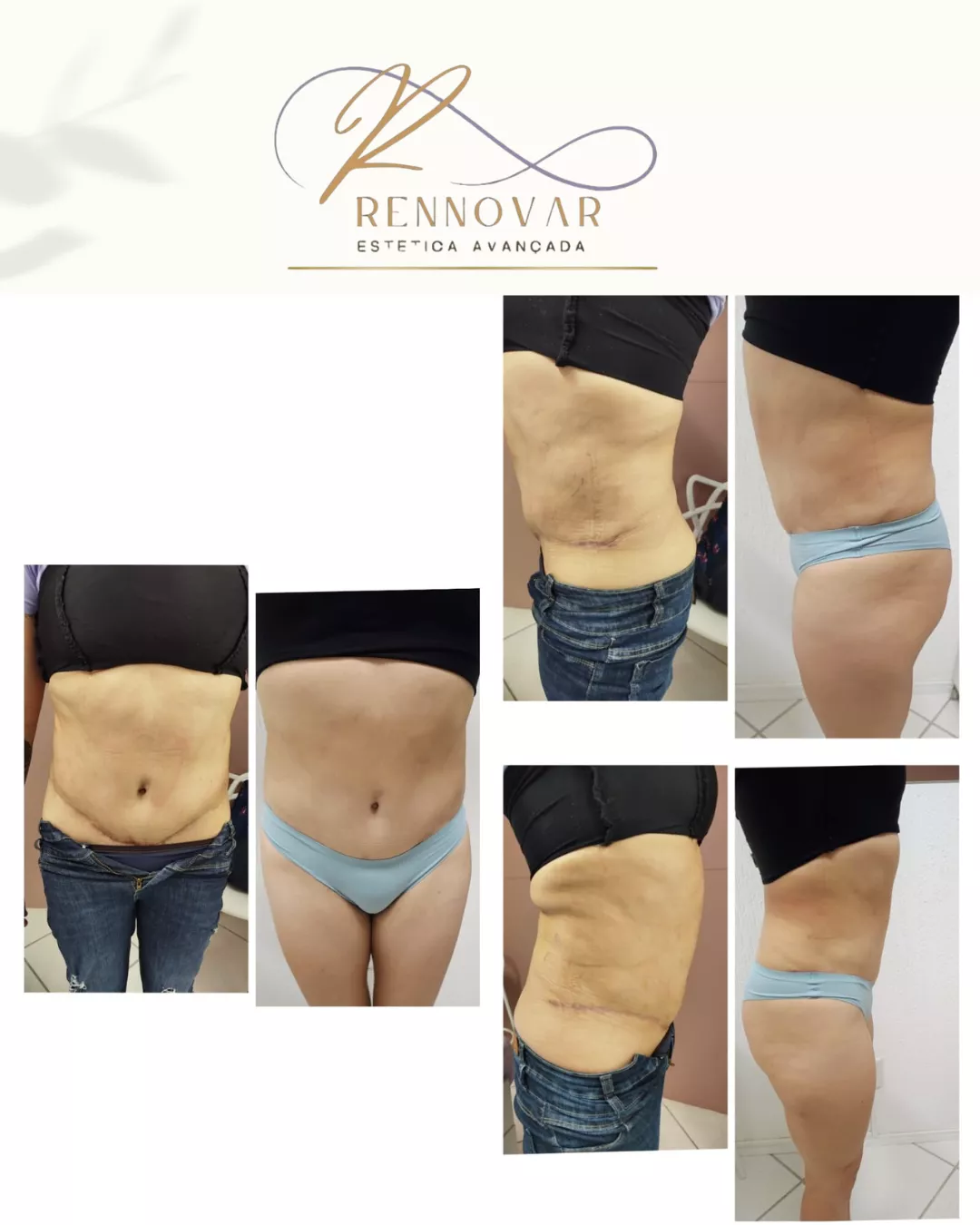 estetica (44)