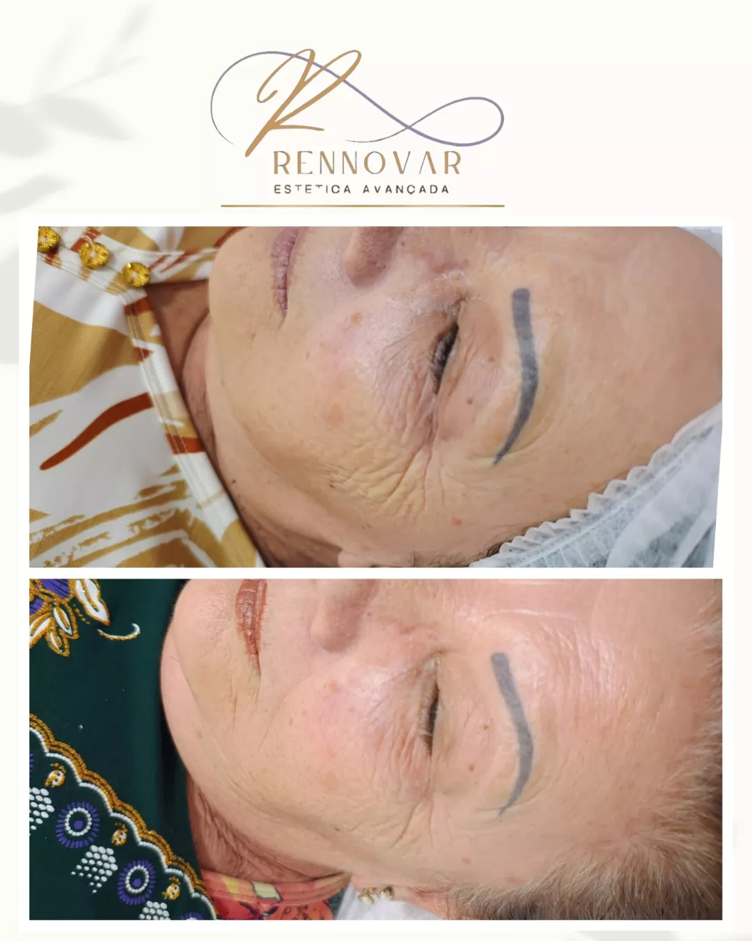 estetica (46)