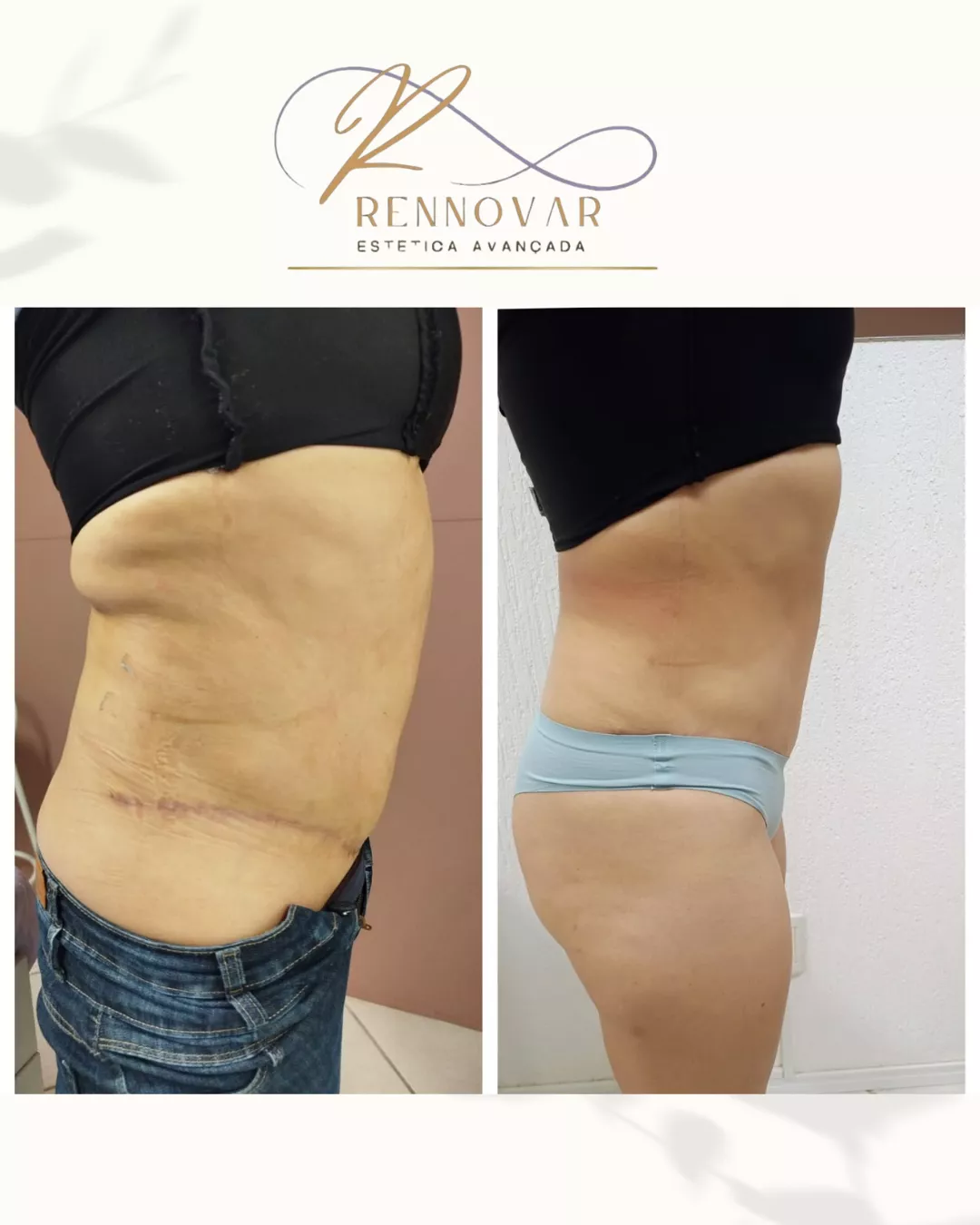 estetica (47)