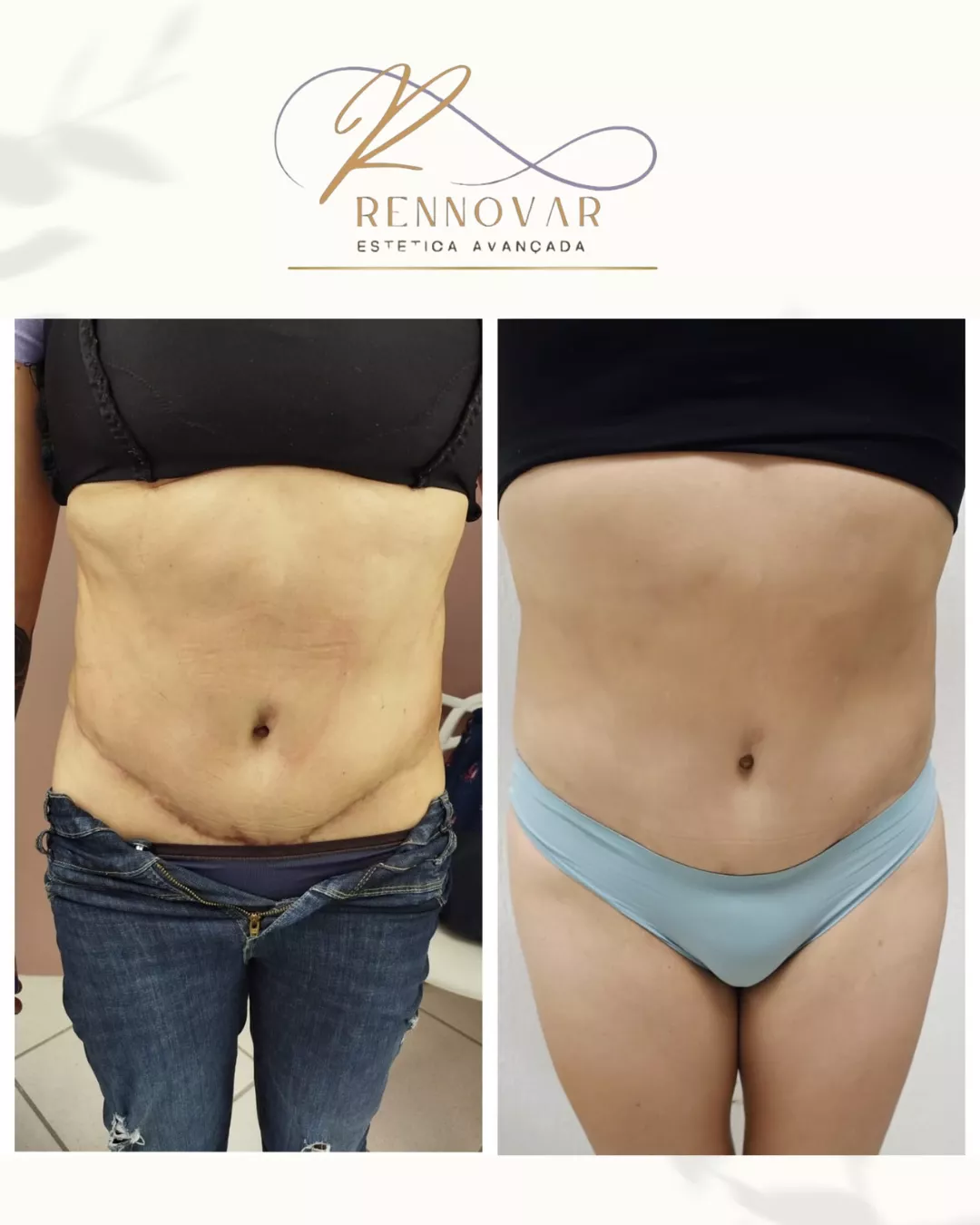 estetica (48)