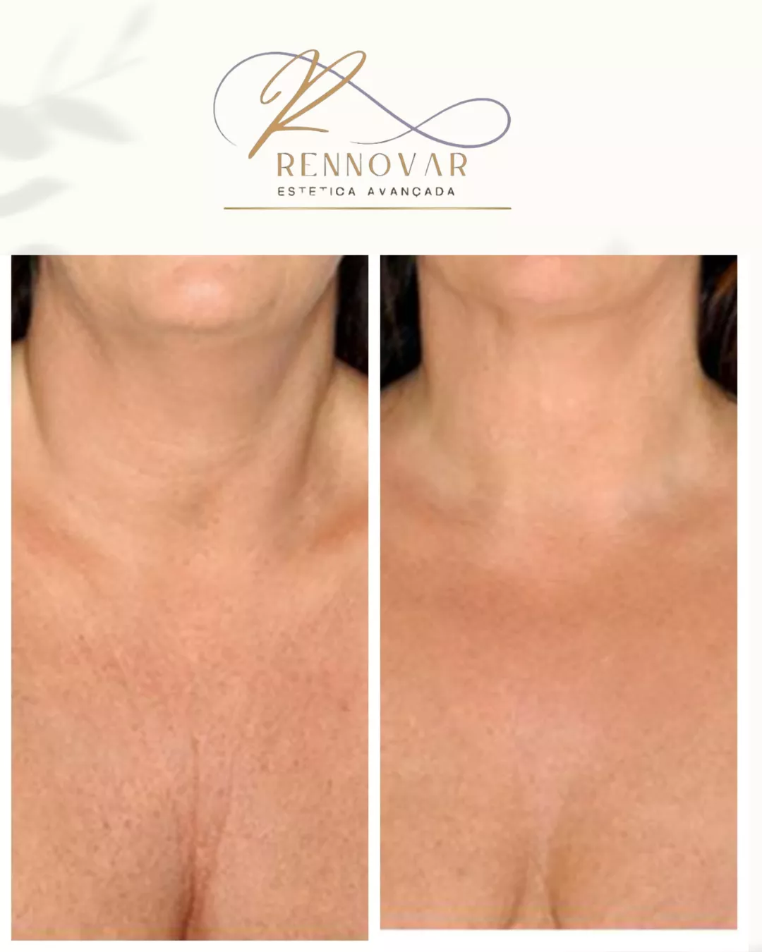 estetica (49)