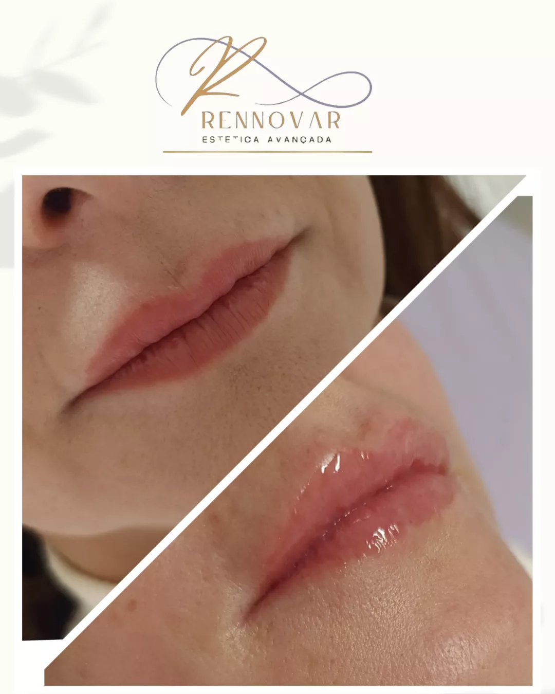 estetica (51)