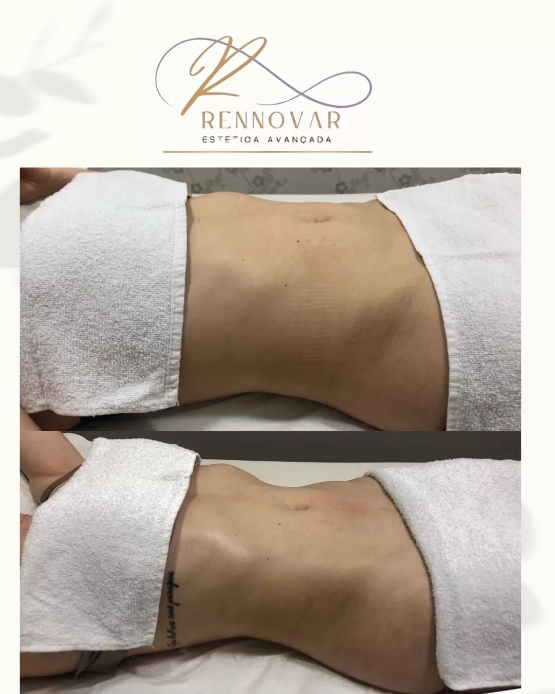 estetica (52)