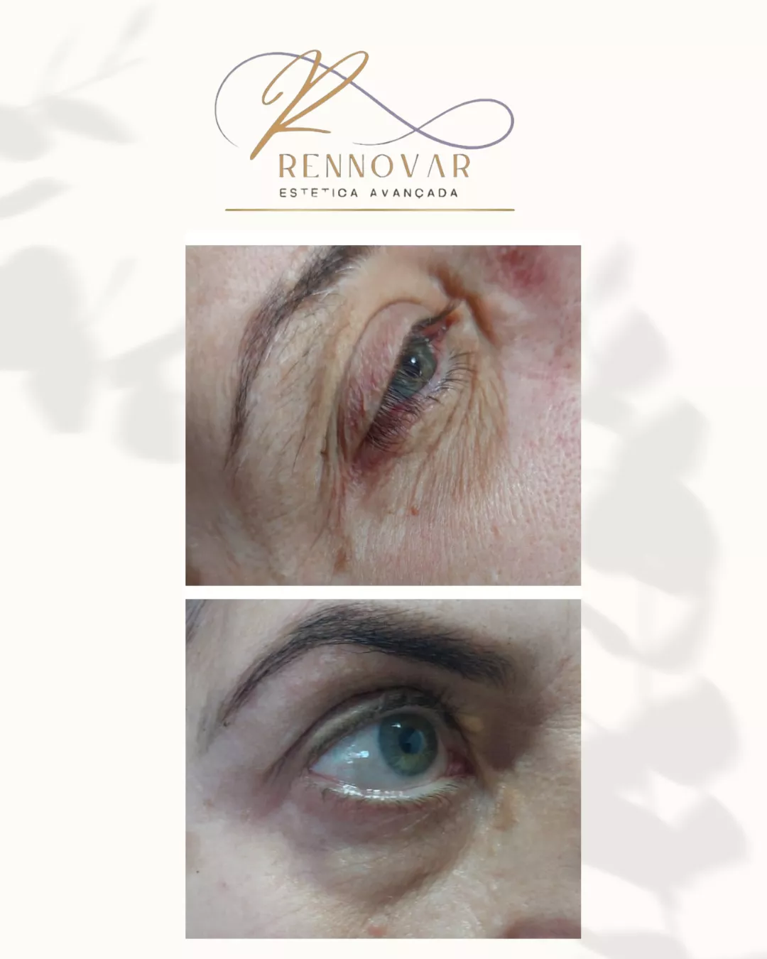 estetica (53)
