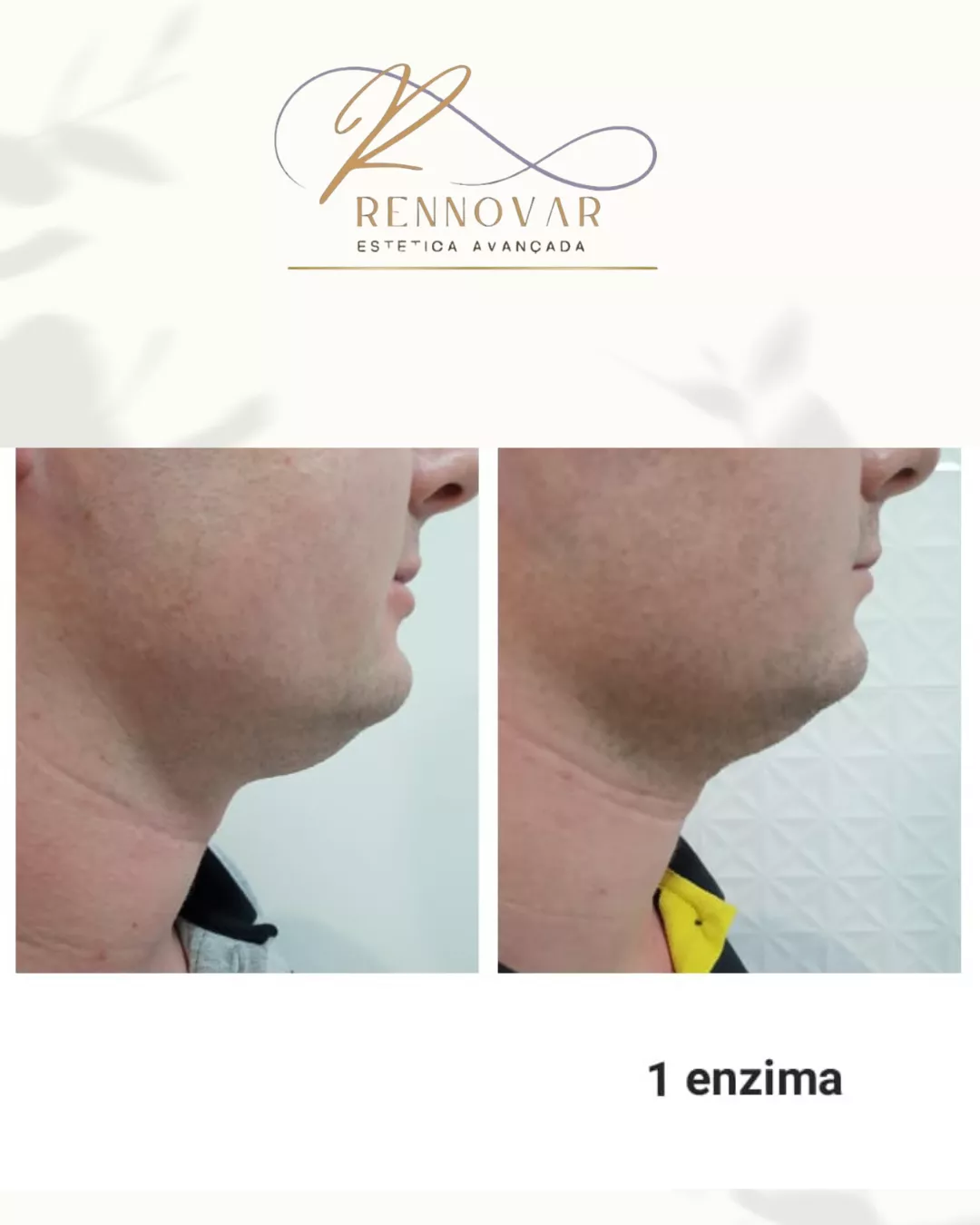 estetica (54)