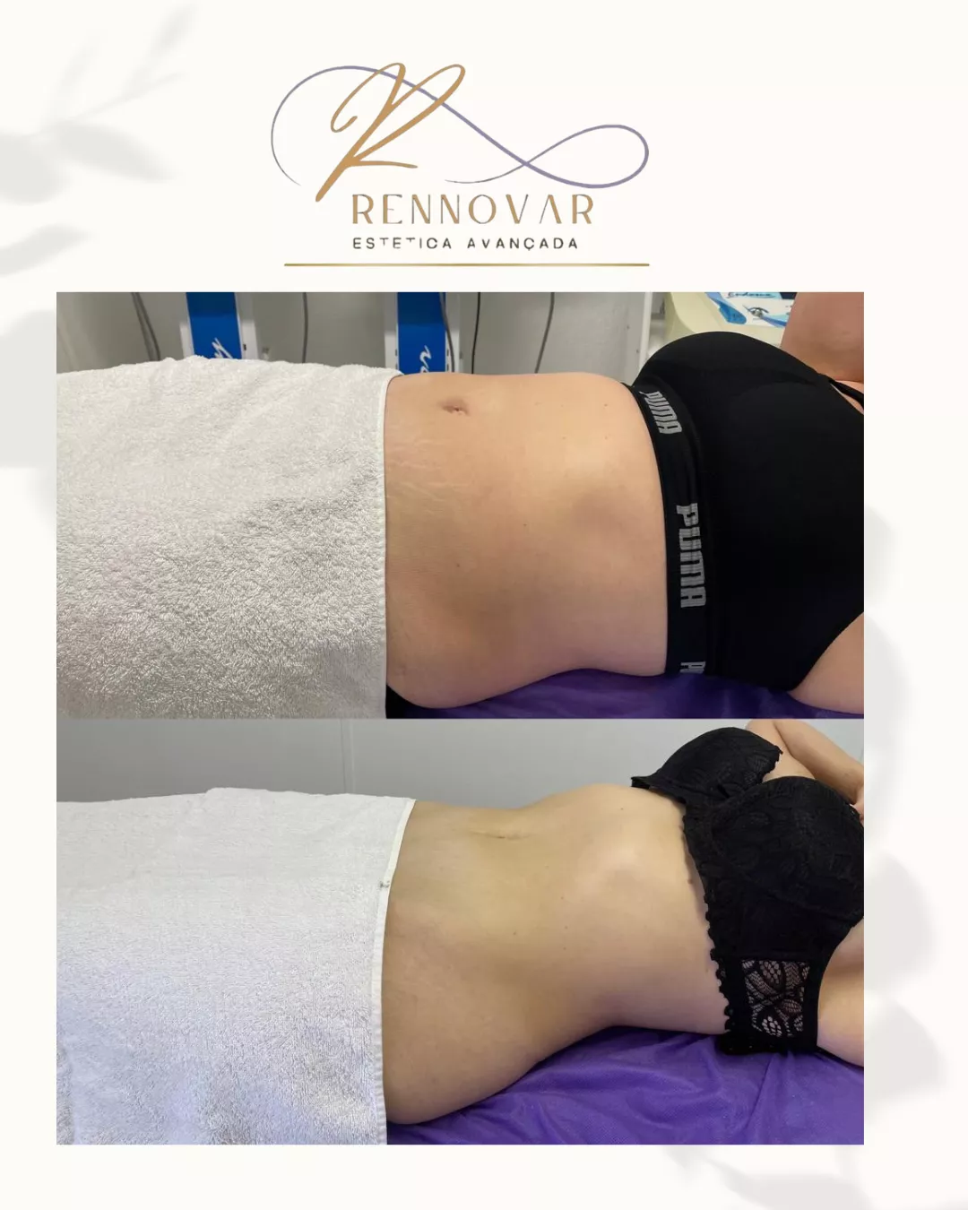 estetica (55)