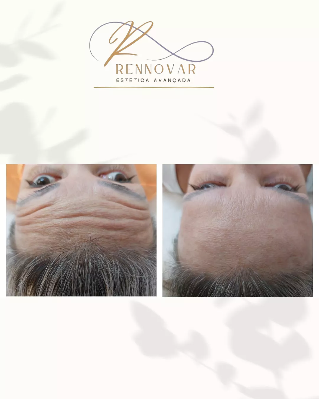 estetica (56)